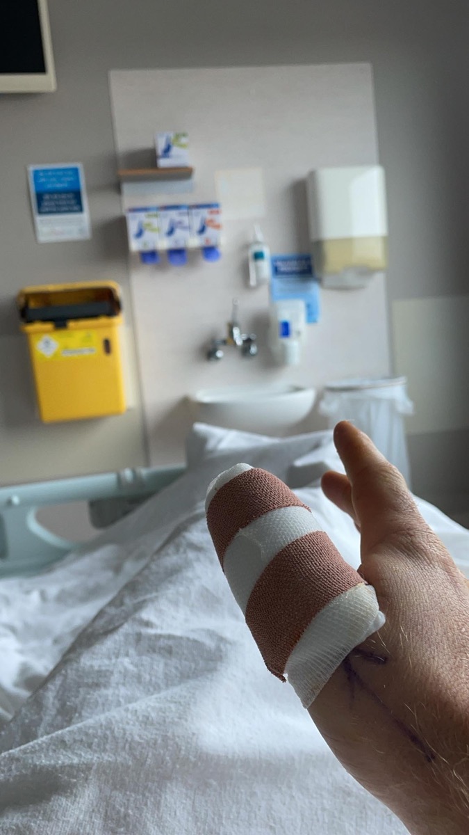 Alex's bandaged thumb in a hospital bed
